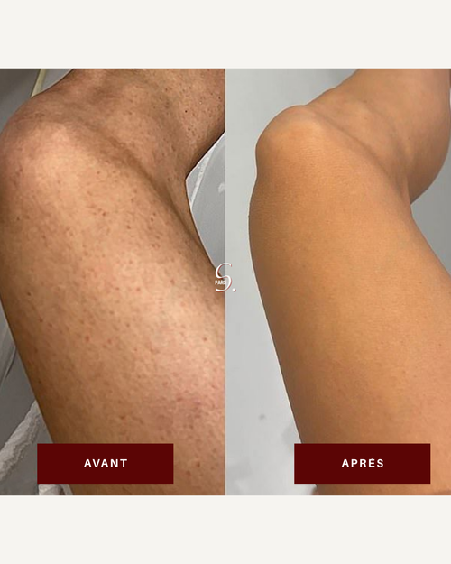 Gant exfoliant en soie — Corps
